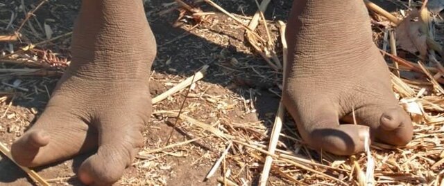 تصاویر / گونه های آفریقایی با پاهای عجیب