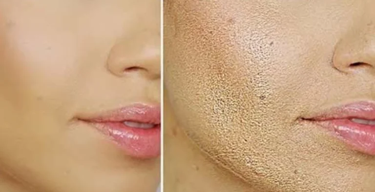 چگونه کرم پودر بزنیم که ماسیده نشود؟