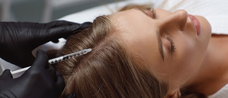 Benefits of hair mesotherapy