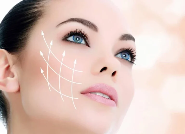 چند نوع روش برای لیفتینگ گونه وجود دارد؟