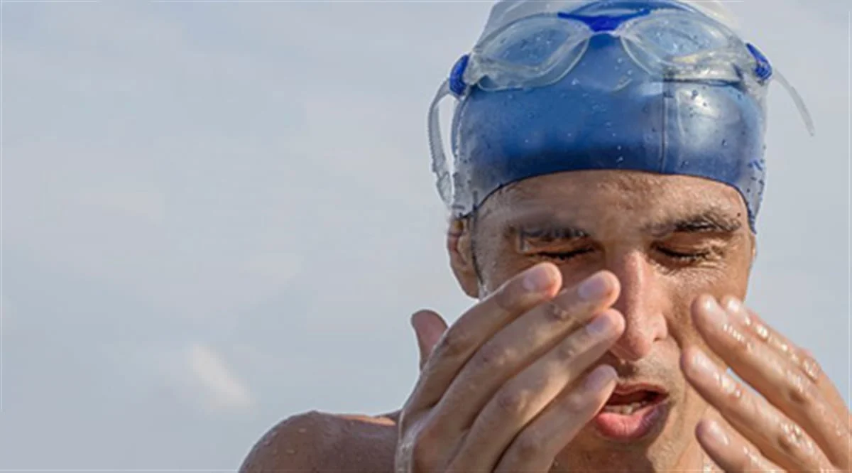 Burning eyes after swimming
