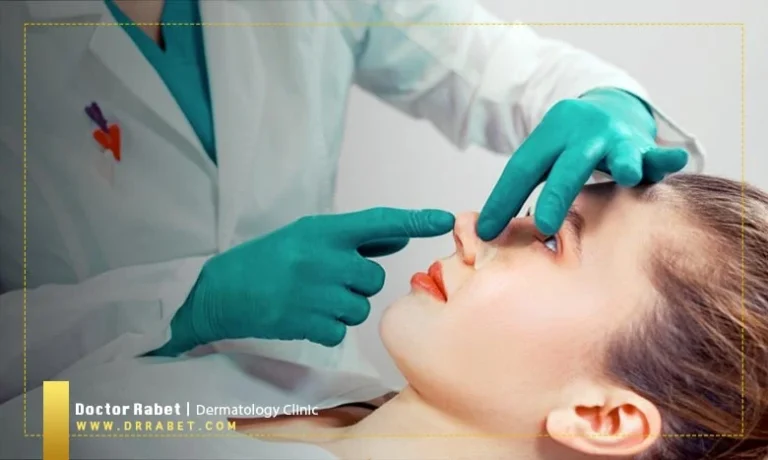 روش های اصلاح فرم بینی بدون نیاز به جراحی