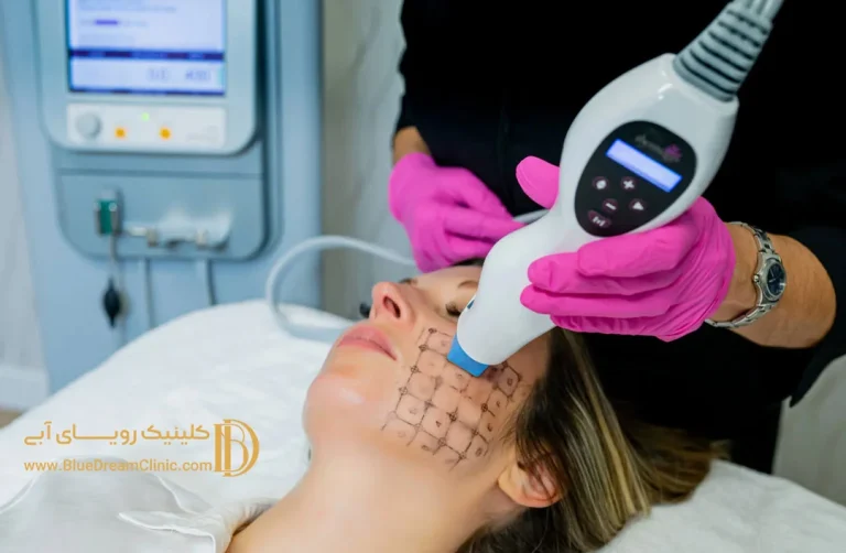 هزینه ترماژ چشم چقدر است؟ تجربه های واقعی کاربران از این روش جوانسازی پوست