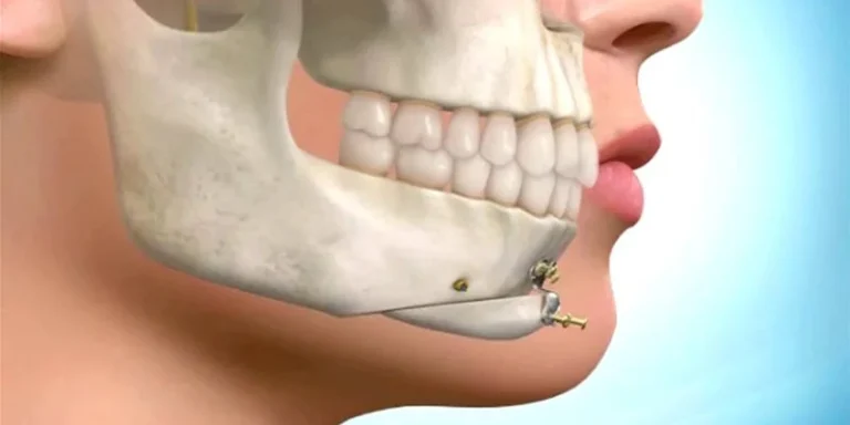 بهترین جراح فک و صورت در اصفهان| راهنمای انتخاب مطمئن برای زیبایی و سلامتی