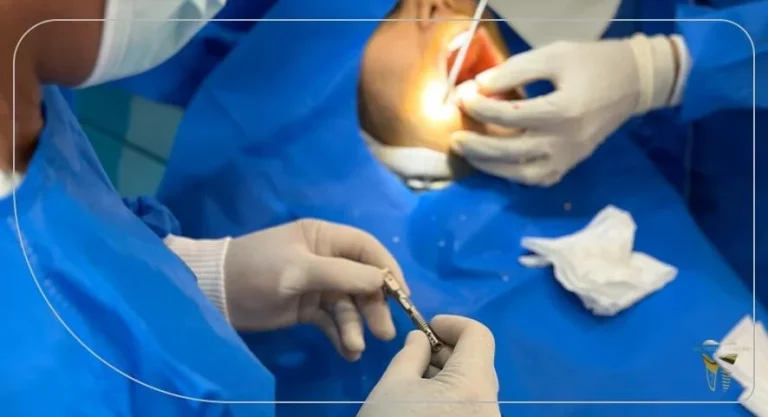 مزایا و معایب ایمپلنت دیجیتال : سریع ترین روش جایگزینی دندان های از دست رفته