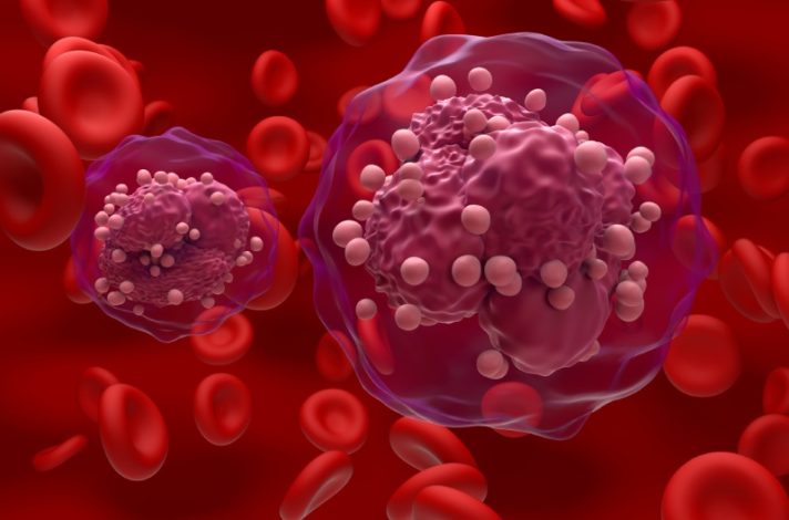 سرطان و نقش لخته‌ های خون در مرگ بیماران