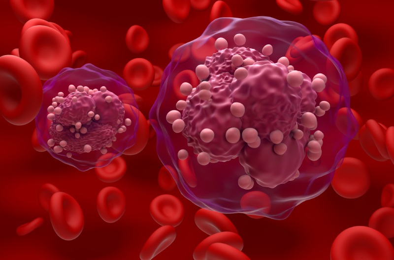 سرطان و نقش لخته‌ های خون در مرگ بیماران