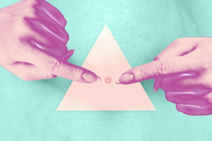 هشدار متخصصان درباره جوش‌ ها و ناحیه مثلث مرگ صورت